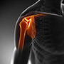 Shoulder dislocations & Instability