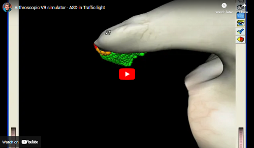 Arthroscopic VR simulator - ASD in Traffic light