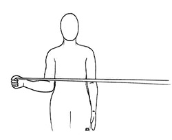 arthoscopy