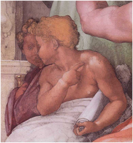 Michelangelo Shoulder Pain